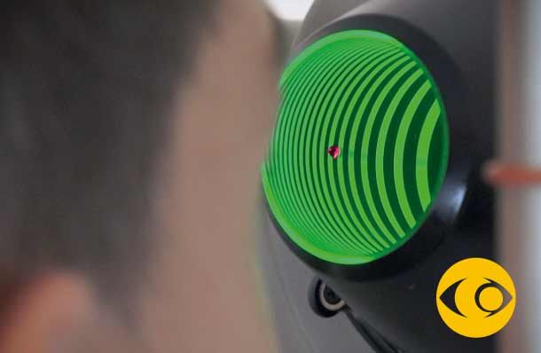 ALTERACIONES-CORNEALES TRATAMIENTO DE ALTERACIONES CORNEALES