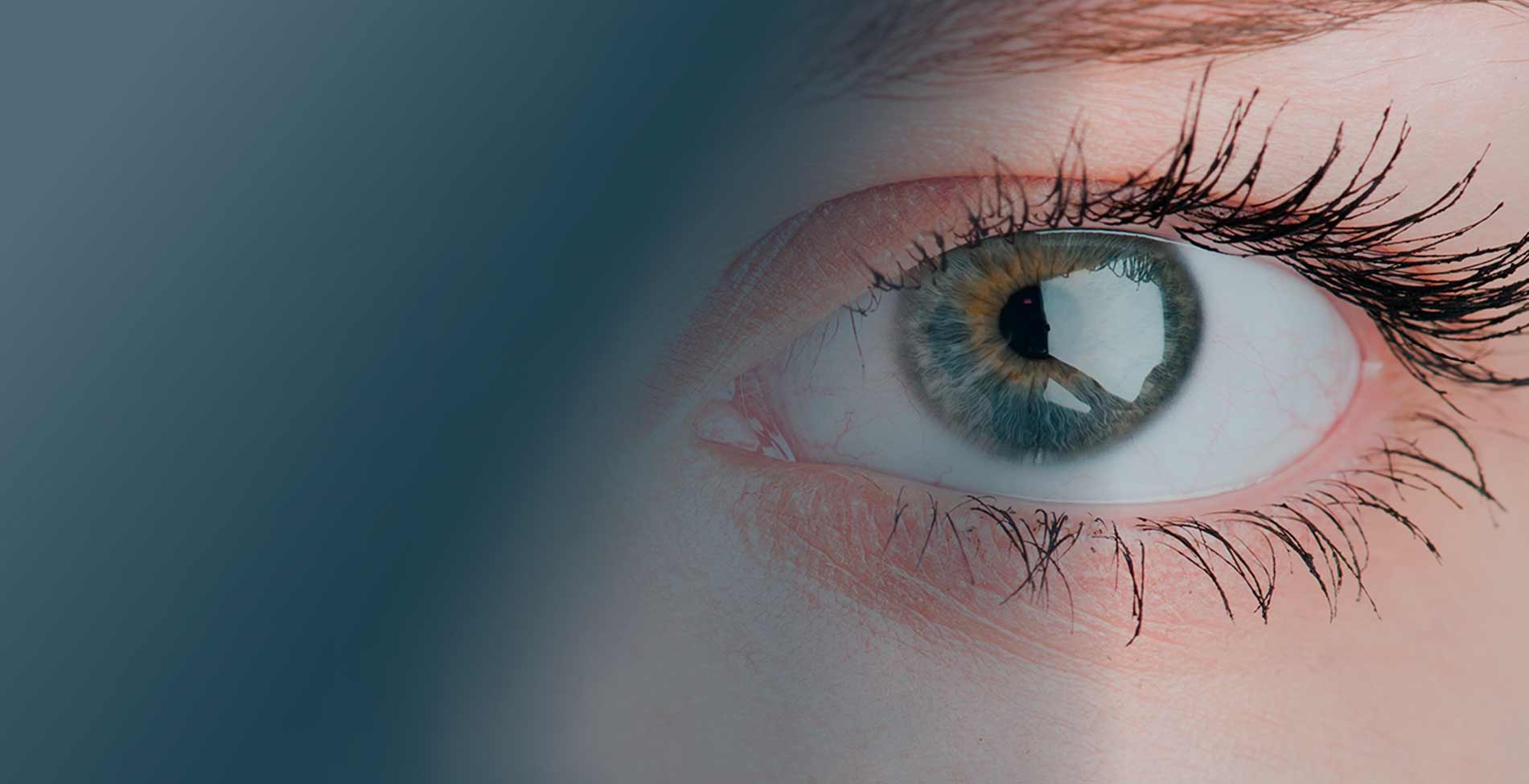 Centro Gimenez Gil especialistas en queratonos y Orto-k